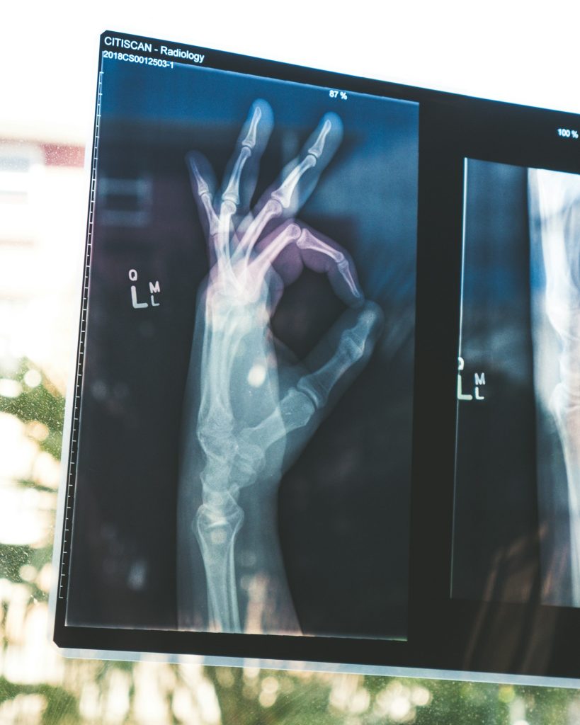 Medical X-ray images on a diagnostic light box